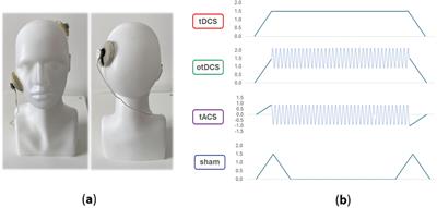 The subjective experience of transcranial electrical stimulation: a within-subject comparison of tolerability and side effects between tDCS, tACS, and otDCS